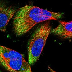 DCP1B Antibody, Novus Biologicals:Antibodies:Primary Antibodies